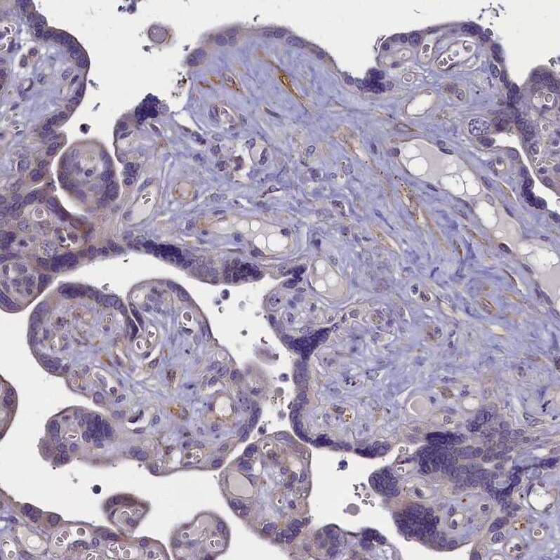 Mrc2 Antibody - BSA Free Immunohistochemistry-Paraffin: Mrc2 Antibody - BSA Free [NBP1-85768]