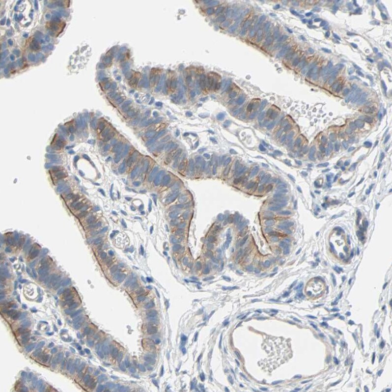 TWEAK R/TNFRSF12 Antibody - BSA Free Immunohistochemistry-Paraffin: TWEAK R/TNFRSF12 Antibody - BSA Free [NBP1-85770]