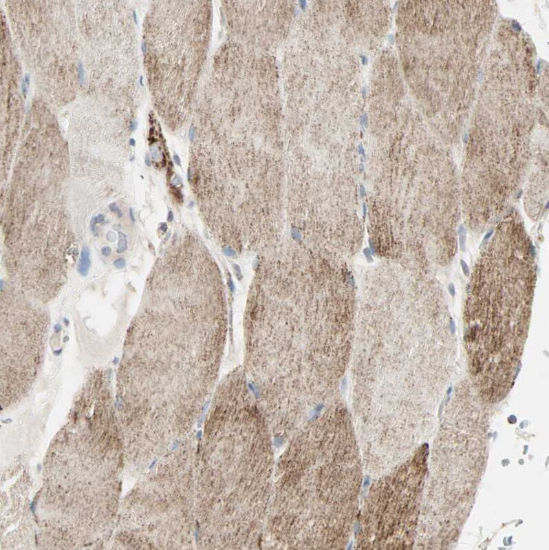 IDH2 Antibody Immunohistochemistry: IDH2 Antibody [IDH2 Antibody]