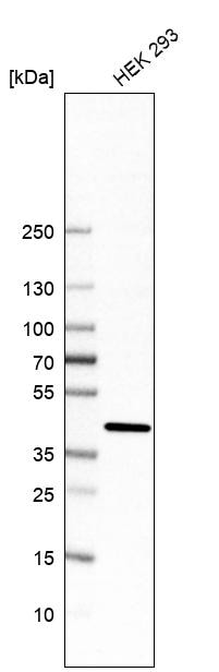 Mannose Phosphate Isomerase Antibody - BSA Free Western Blot: Mannose Phosphate Isomerase Antibody - BSA Free [NBP1-85787]