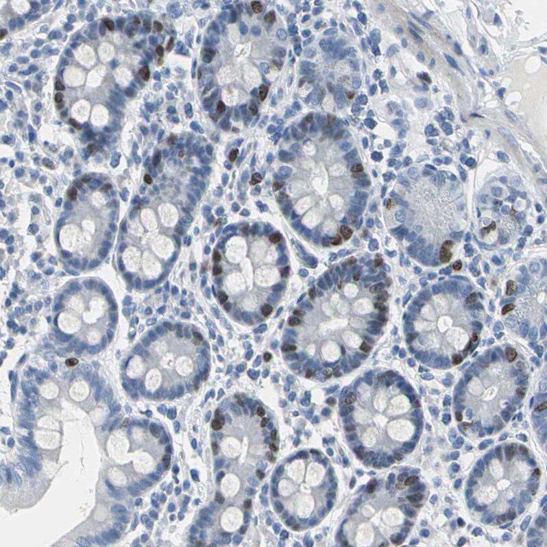 MCM3 Antibody - BSA Free Immunohistochemistry-Paraffin: MCM3 Antibody - BSA Free [NBP1-85796]