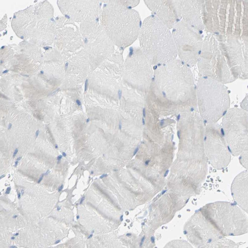 MCM3 Antibody - BSA Free Immunohistochemistry-Paraffin: MCM3 Antibody - BSA Free [NBP1-85796]
