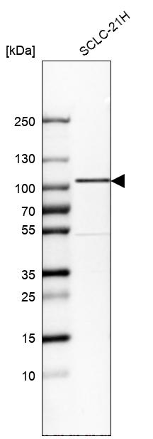 GIT1 Antibody - BSA Free Western Blot: GIT1 Antibody - BSA Free [NBP1-85798]