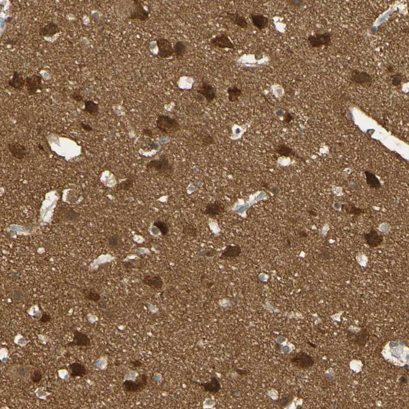 PAK1 Antibody - BSA Free Immunohistochemistry-Paraffin: PAK1 Antibody - BSA Free [NBP1-85802]