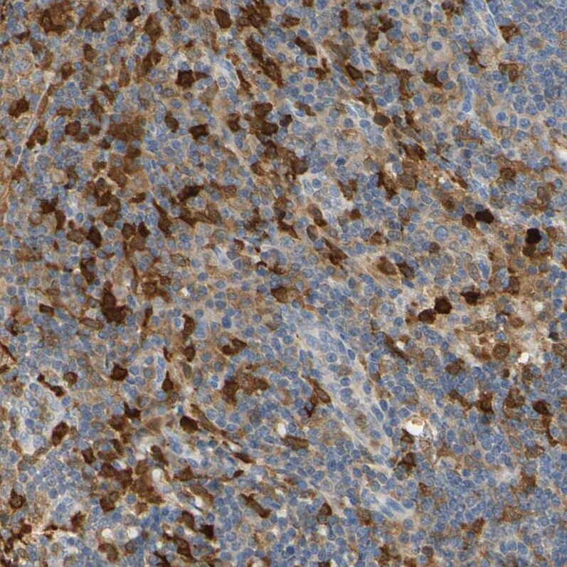 PAK1 Antibody - BSA Free Immunohistochemistry-Paraffin: PAK1 Antibody - BSA Free [NBP1-85802]