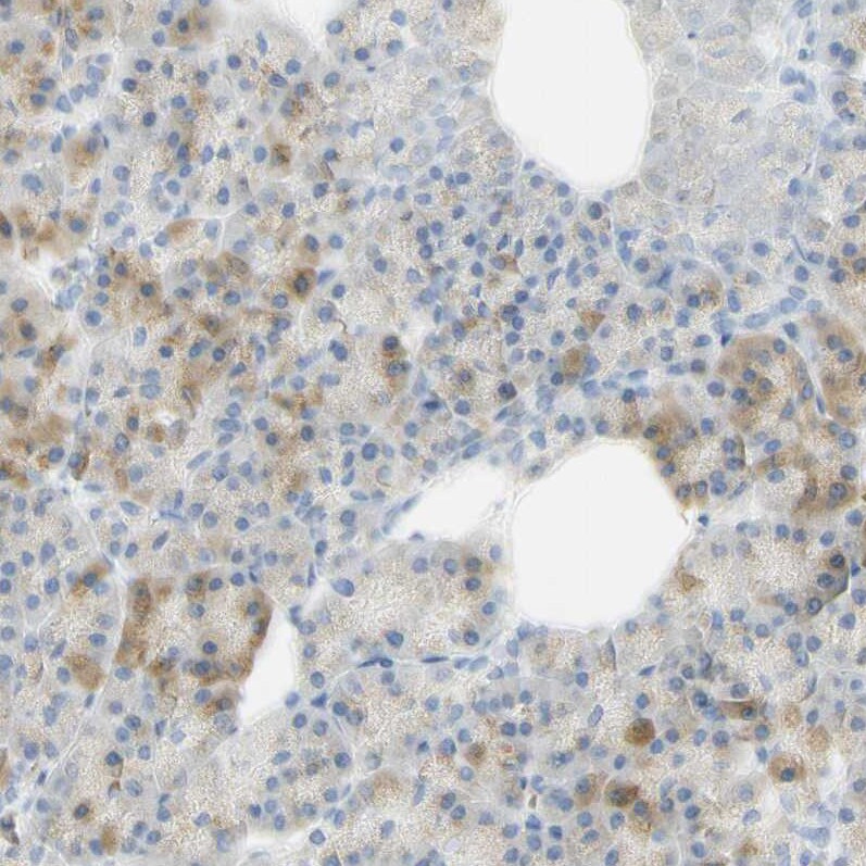 PAK1 Antibody - BSA Free Immunohistochemistry-Paraffin: PAK1 Antibody - BSA Free [NBP1-85802]