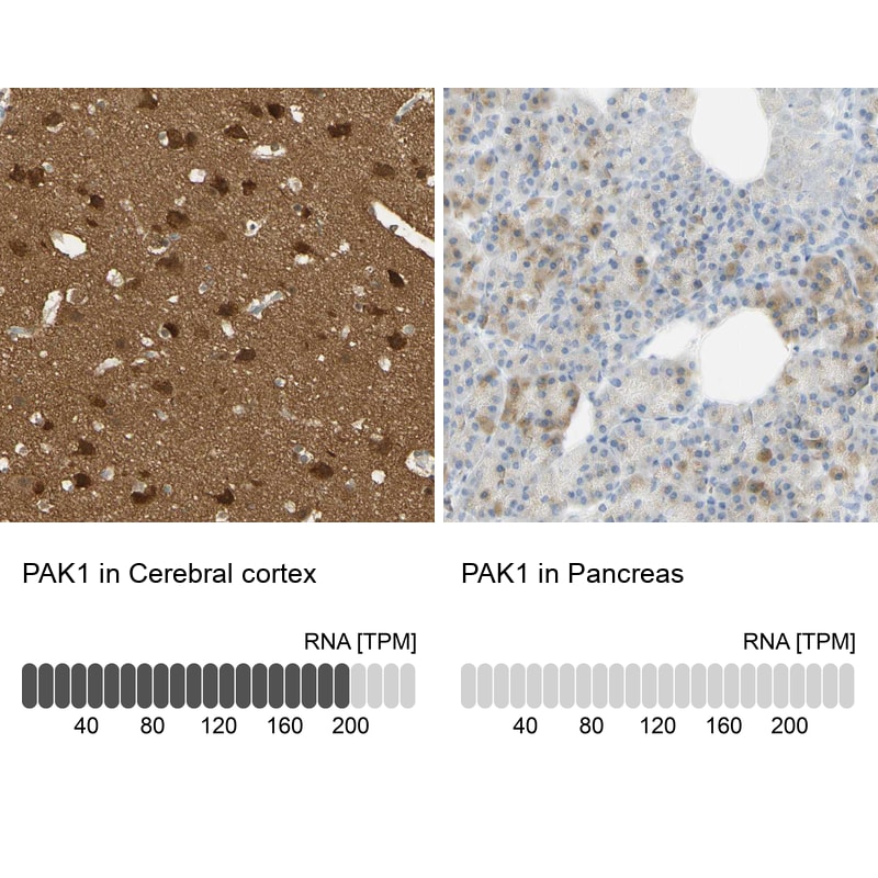 PAK1 Antibody - BSA Free Immunohistochemistry-Paraffin: PAK1 Antibody - BSA Free [NBP1-85802]
