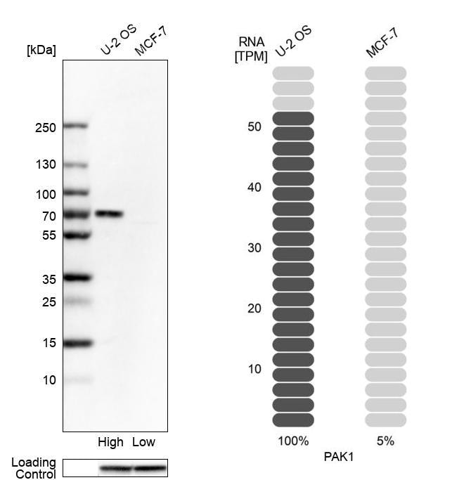 PAK1 Antibody - BSA Free Western Blot: PAK1 Antibody - BSA Free [NBP1-85802]