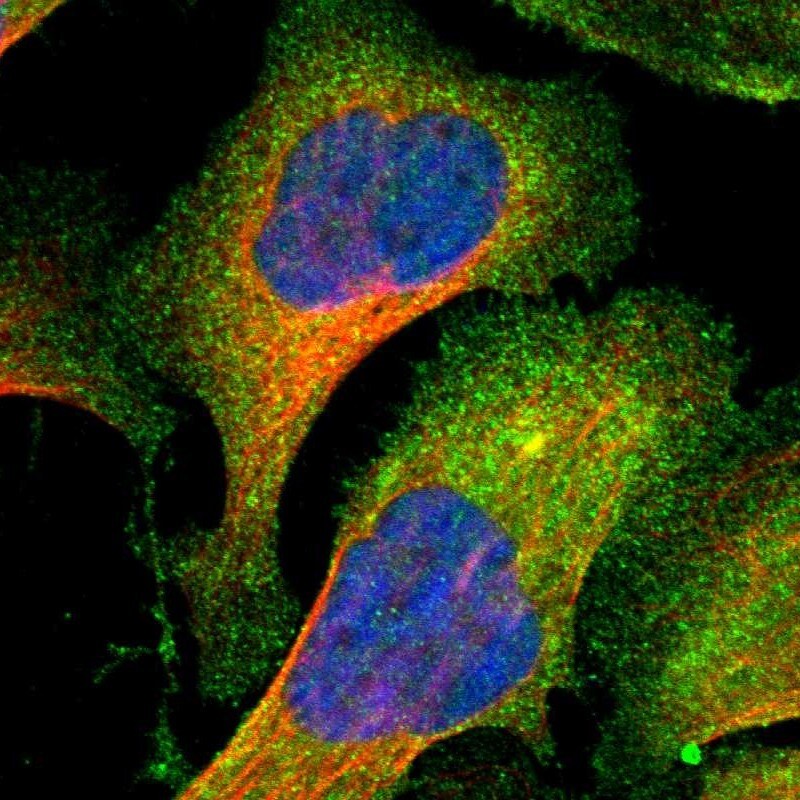 PAK1 Antibody - BSA Free Immunocytochemistry/ Immunofluorescence: PAK1 Antibody - BSA Free [NBP1-85802]