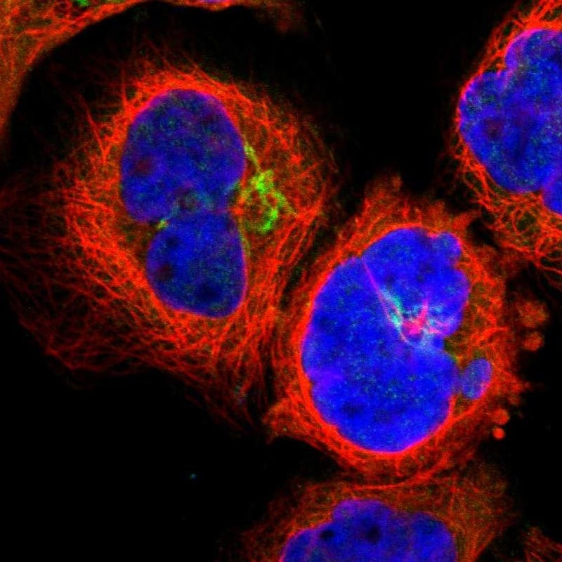 Lck Antibody - BSA Free Immunocytochemistry/ Immunofluorescence: Lck Antibody [NBP1-85804]