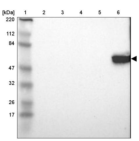 Lck Antibody - BSA Free Western Blot: Lck Antibody - BSA Free [NBP1-85804]