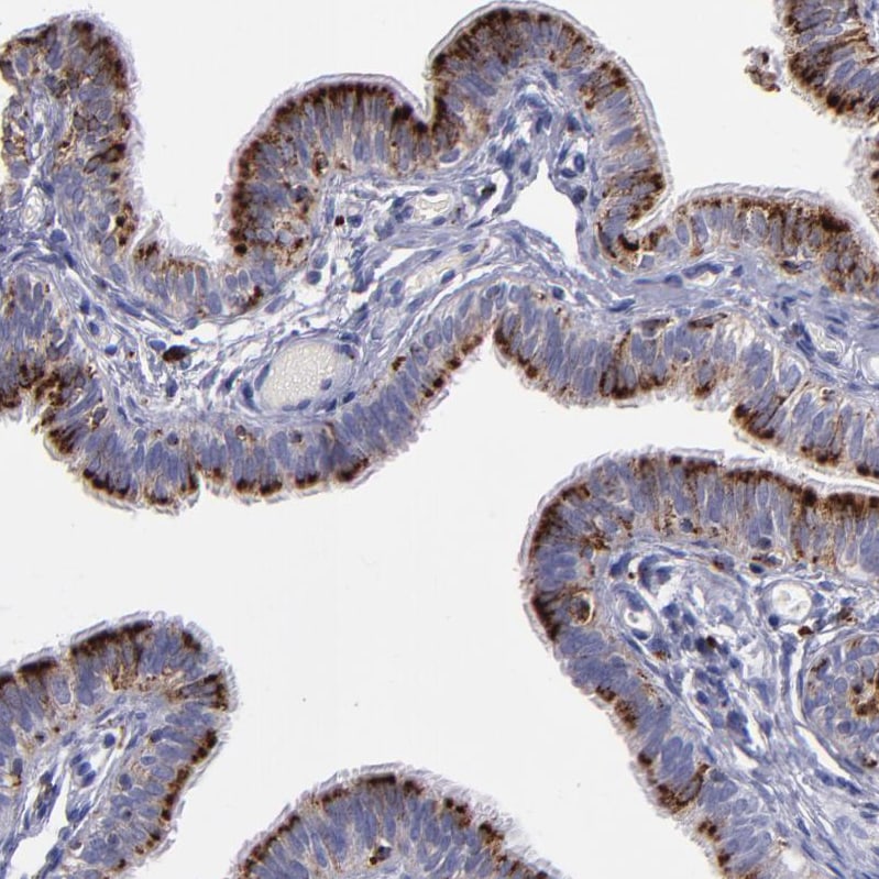 Cathepsin S Antibody - BSA Free Immunohistochemistry-Paraffin: Cathepsin S Antibody - BSA Free [NBP1-85807]