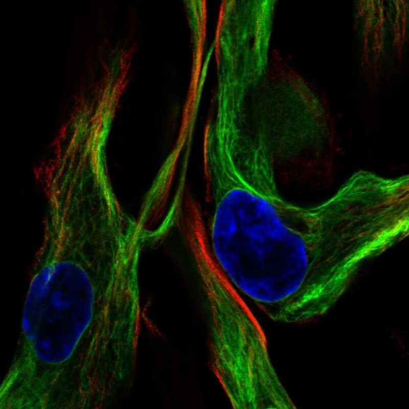 Vimentin Antibody - BSA Free Immunocytochemistry/ Immunofluorescence: Vimentin Antibody [NBP1-85814]