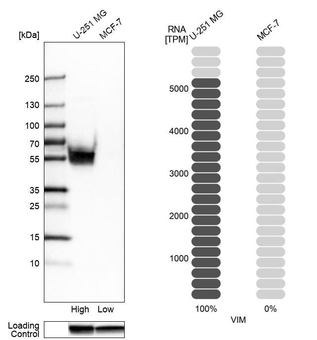 Vimentin Antibody - BSA Free Western Blot: Vimentin Antibody - BSA Free [NBP1-85814]