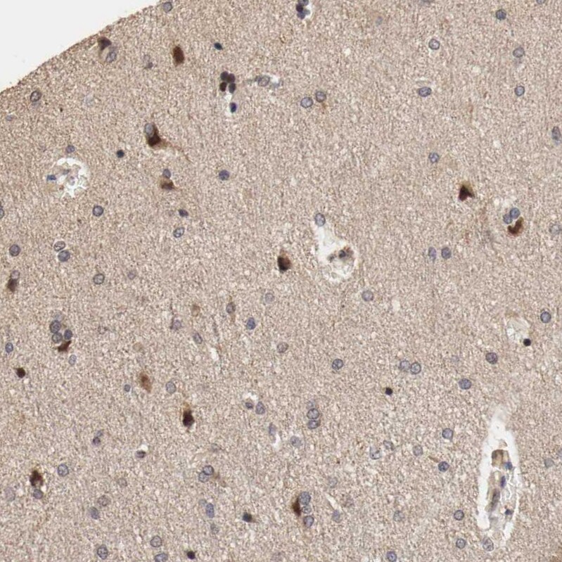 DNMT3B Antibody - BSA Free Immunohistochemistry-Paraffin: DNMT3B Antibody - BSA Free [NBP1-85815]