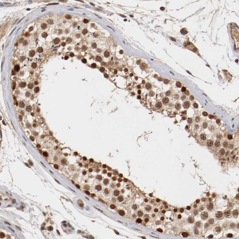 DNMT3B Antibody - BSA Free Immunohistochemistry-Paraffin: DNMT3B Antibody - BSA Free [NBP1-85815]