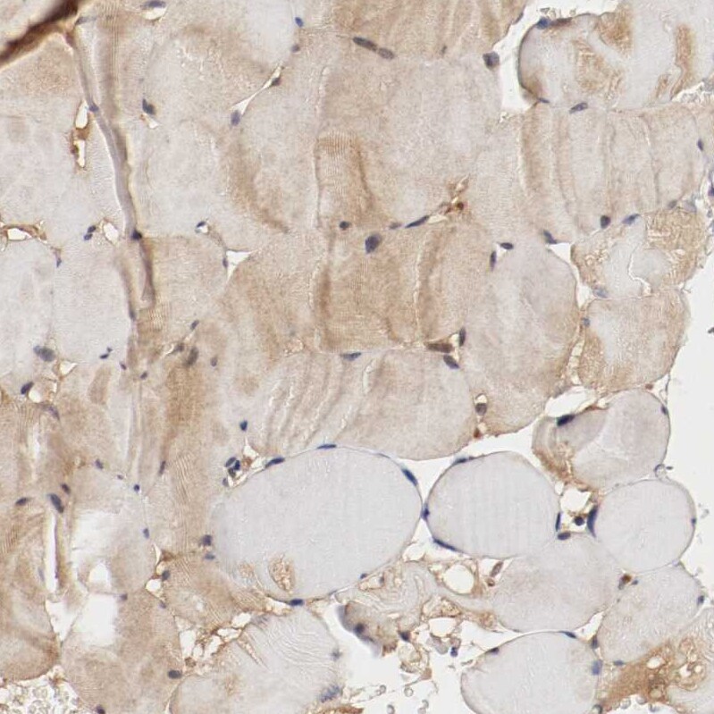 DNMT3B Antibody - BSA Free Immunohistochemistry-Paraffin: DNMT3B Antibody - BSA Free [NBP1-85815]