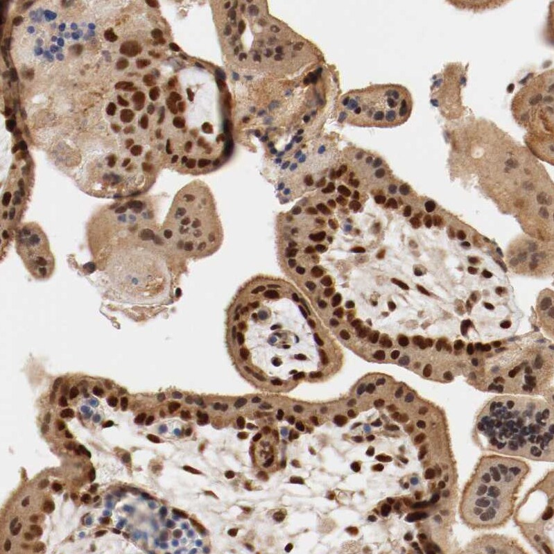 DNMT3B Antibody - BSA Free Immunohistochemistry-Paraffin: DNMT3B Antibody - BSA Free [NBP1-85815]