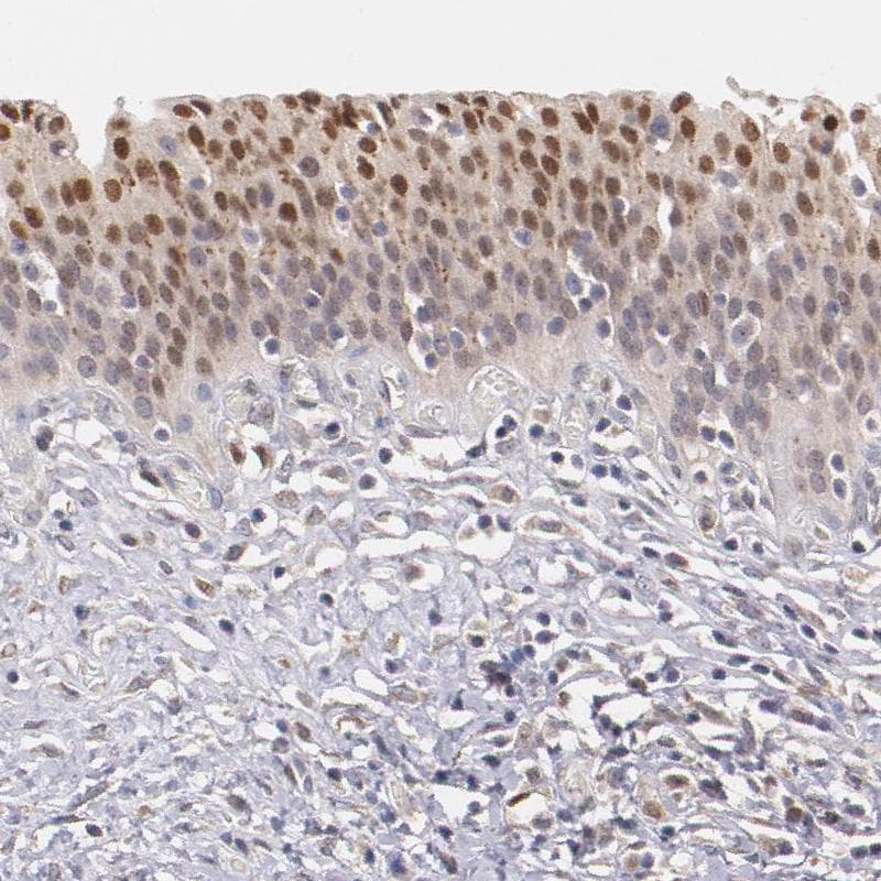 ATF3 Antibody - BSA Free Immunohistochemistry-Paraffin: ATF3 Antibody - BSA Free [NBP1-85816]