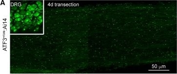 ATF3 Antibody