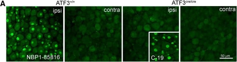 ATF3 Antibody