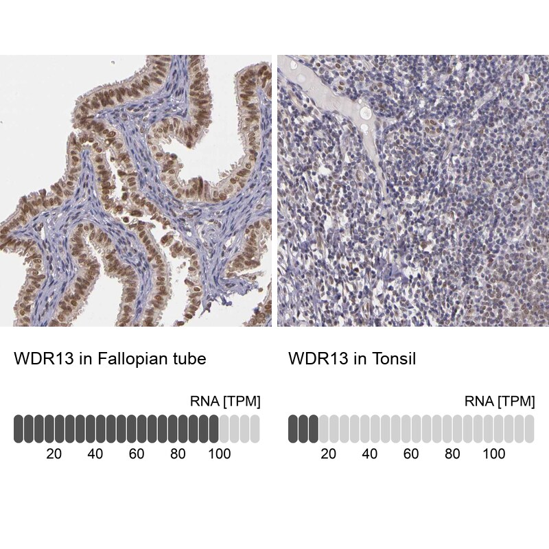 WDR13 Antibody - BSA Free Immunohistochemistry-Paraffin: WDR13 Antibody - BSA Free [NBP1-85820]