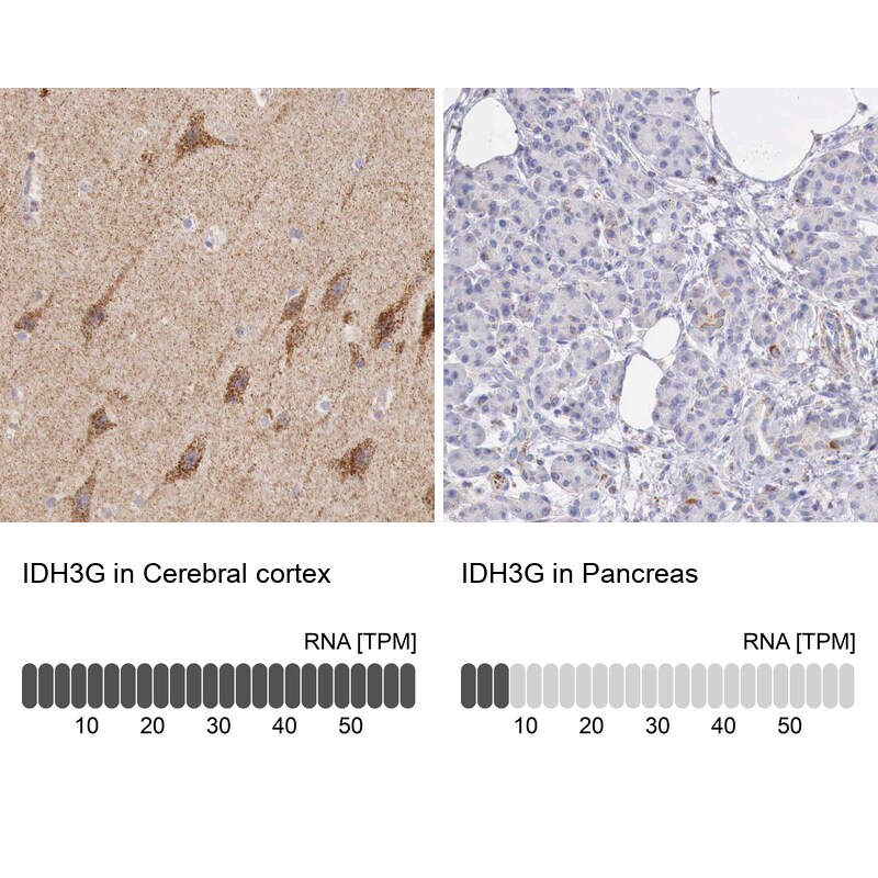 IDH3G Antibody - BSA Free Immunohistochemistry-Paraffin: IDH3G Antibody [NBP1-85824]