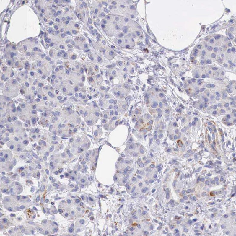 IDH3G Antibody - BSA Free Immunohistochemistry-Paraffin: IDH3G Antibody [NBP1-85824]