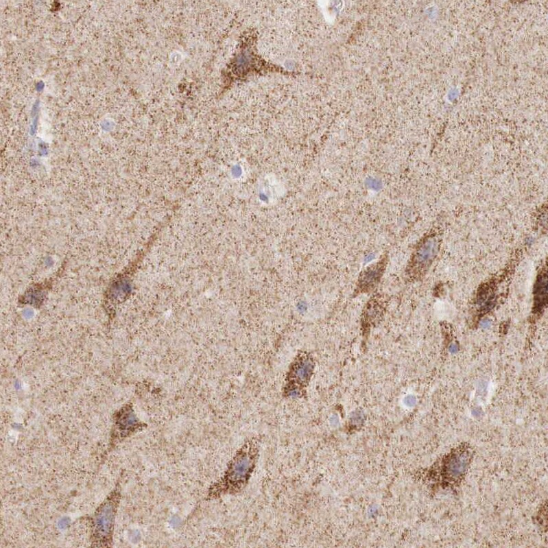 IDH3G Antibody - BSA Free Immunohistochemistry-Paraffin: IDH3G Antibody [NBP1-85824]