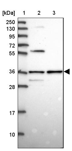 SNX11 Antibody - BSA Free Western Blot: SNX11 Antibody - BSA Free [NBP1-85825]