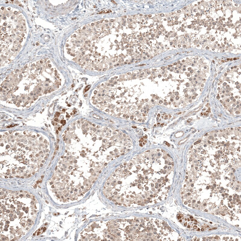 CPNE7 Antibody - BSA Free Immunohistochemistry-Paraffin: CPNE7 Antibody - BSA Free [NBP1-85827]