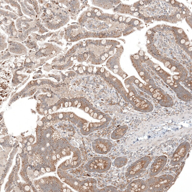 CPNE7 Antibody - BSA Free Immunohistochemistry-Paraffin: CPNE7 Antibody - BSA Free [NBP1-85827]