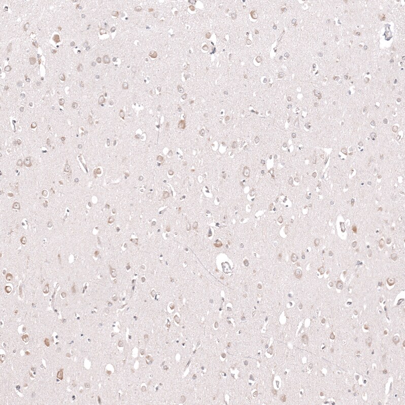 CPNE7 Antibody - BSA Free Immunohistochemistry-Paraffin: CPNE7 Antibody - BSA Free [NBP1-85827]