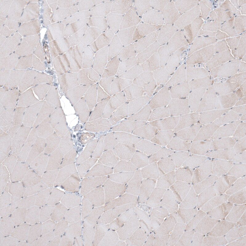 CPNE7 Antibody - BSA Free Immunohistochemistry-Paraffin: CPNE7 Antibody - BSA Free [NBP1-85827]