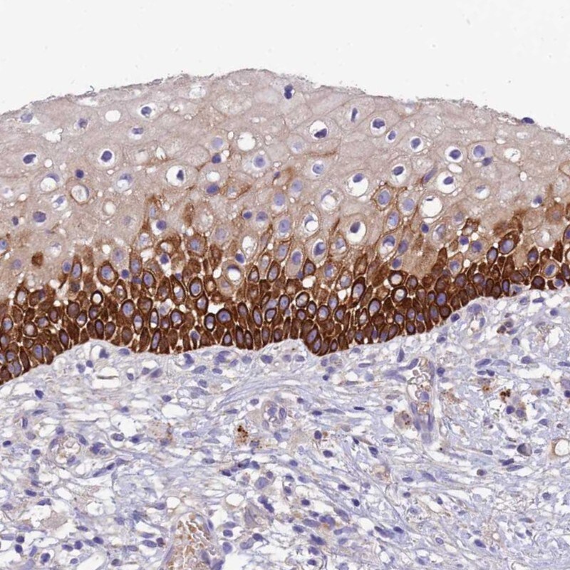 CCDC157 Antibody - BSA Free Immunohistochemistry-Paraffin: CCDC157 Antibody - BSA Free [NBP1-85831]