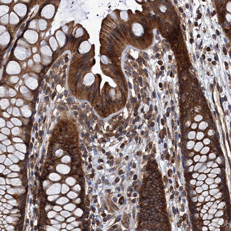 MDM1 Antibody - BSA Free Immunohistochemistry-Paraffin: MDM1 Antibody - BSA Free [NBP1-85839]