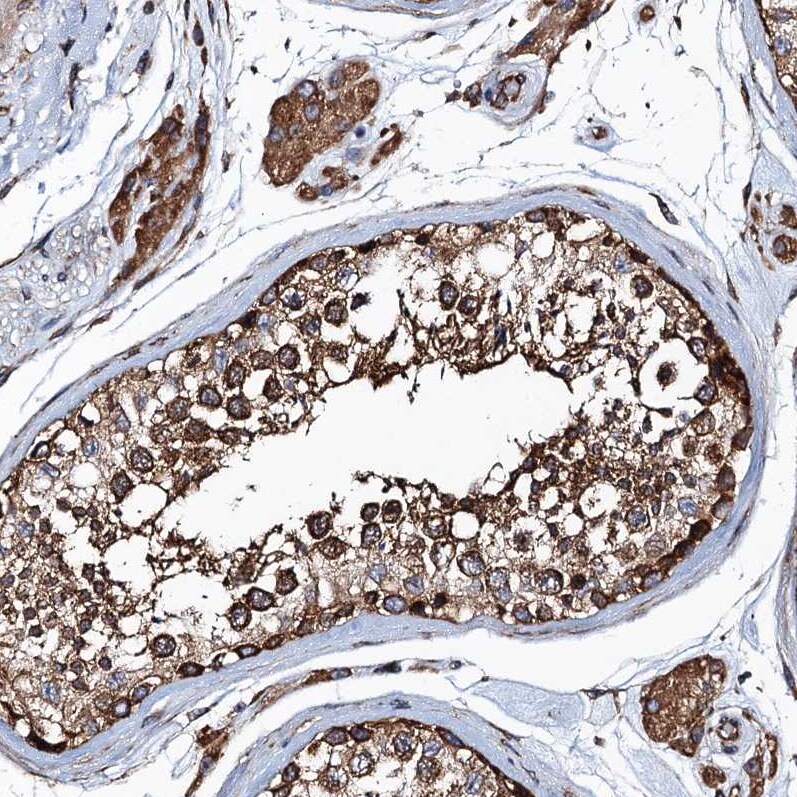 MDM1 Antibody - BSA Free Immunohistochemistry-Paraffin: MDM1 Antibody - BSA Free [NBP1-85839]