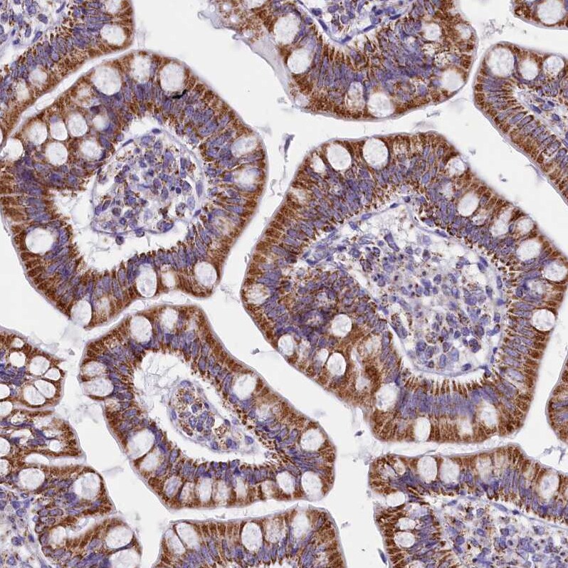 IDH3A Antibody - BSA Free Immunohistochemistry-Paraffin: IDH3A Antibody [NBP1-85840]
