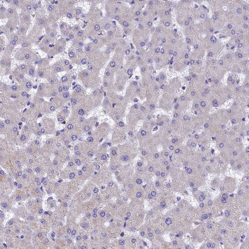 IDH3A Antibody - BSA Free Immunohistochemistry-Paraffin: IDH3A Antibody [NBP1-85840]