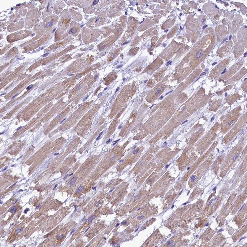 IDH3A Antibody - BSA Free Immunohistochemistry-Paraffin: IDH3A Antibody [NBP1-85840]