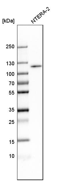 BICD1 Antibody - BSA Free Western Blot: BICD1 Antibody - BSA Free [NBP1-85843]
