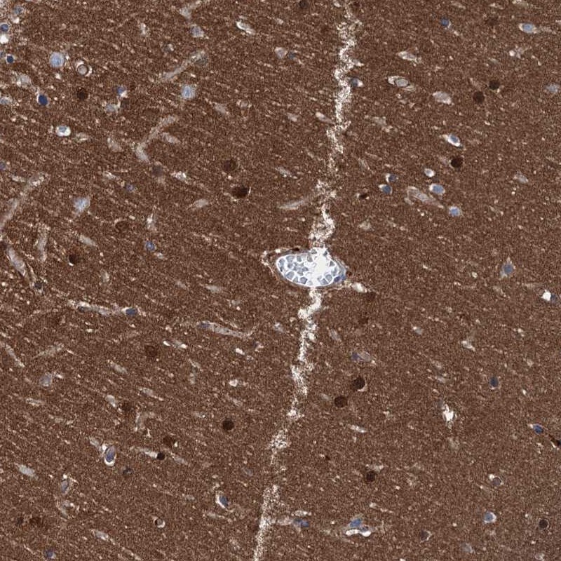 CBLN3 Antibody - BSA Free Immunohistochemistry-Paraffin: CBLN3 Antibody [NBP1-85844]
