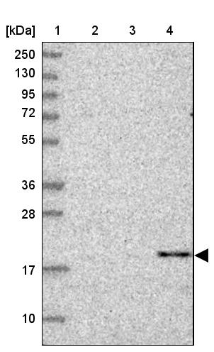 CBLN3 Antibody - BSA Free Western Blot: CBLN3 Antibody - BSA Free [NBP1-85844]