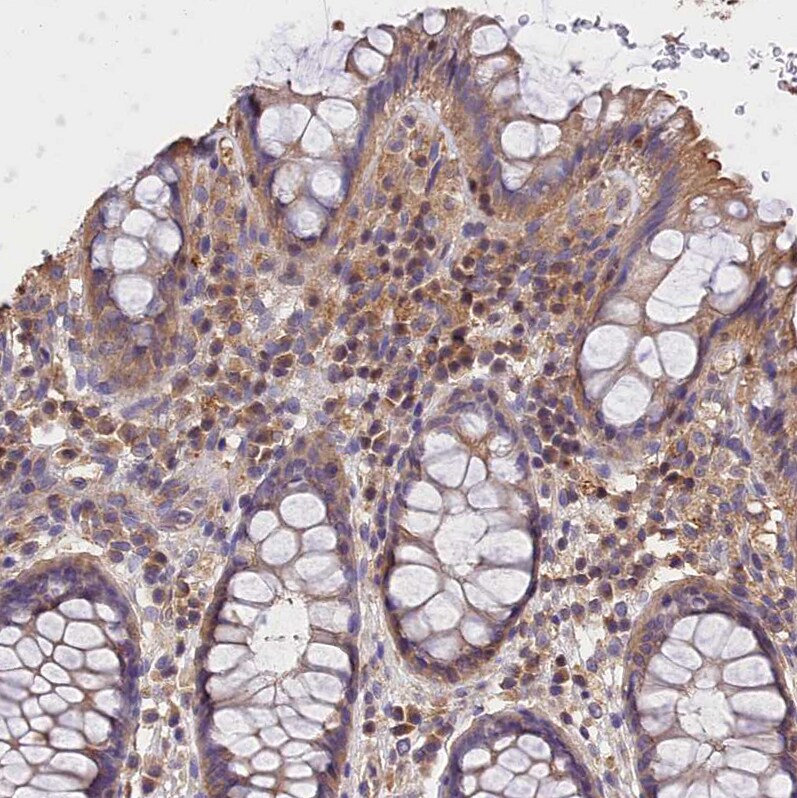 OAS3 Antibody - BSA Free Immunohistochemistry-Paraffin: OAS3 Antibody - BSA Free [NBP1-85845]