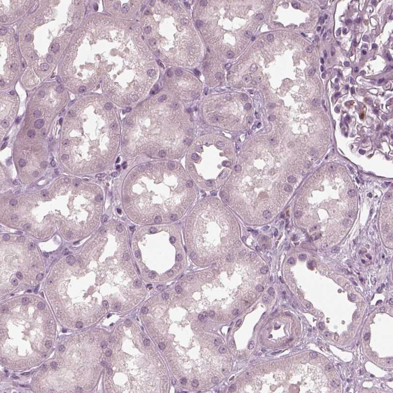 PSTPIP2 Antibody - BSA Free Immunohistochemistry-Paraffin: PSTPIP2 Antibody - BSA Free [NBP1-85846]