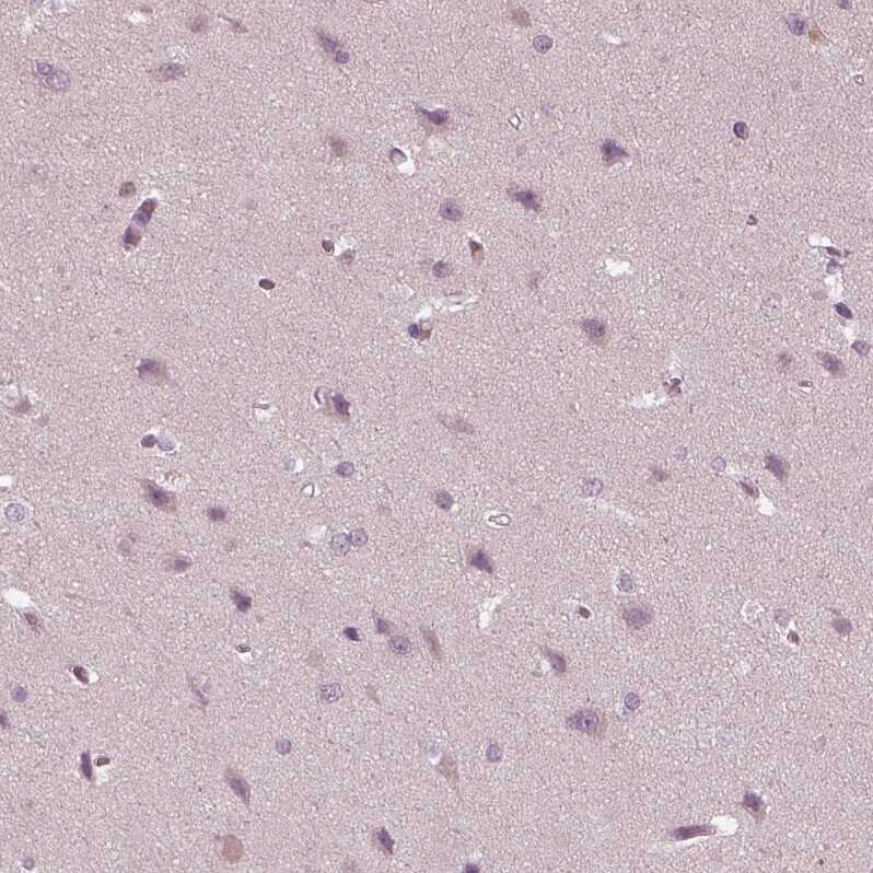 PSTPIP2 Antibody - BSA Free Immunohistochemistry-Paraffin: PSTPIP2 Antibody - BSA Free [NBP1-85846]