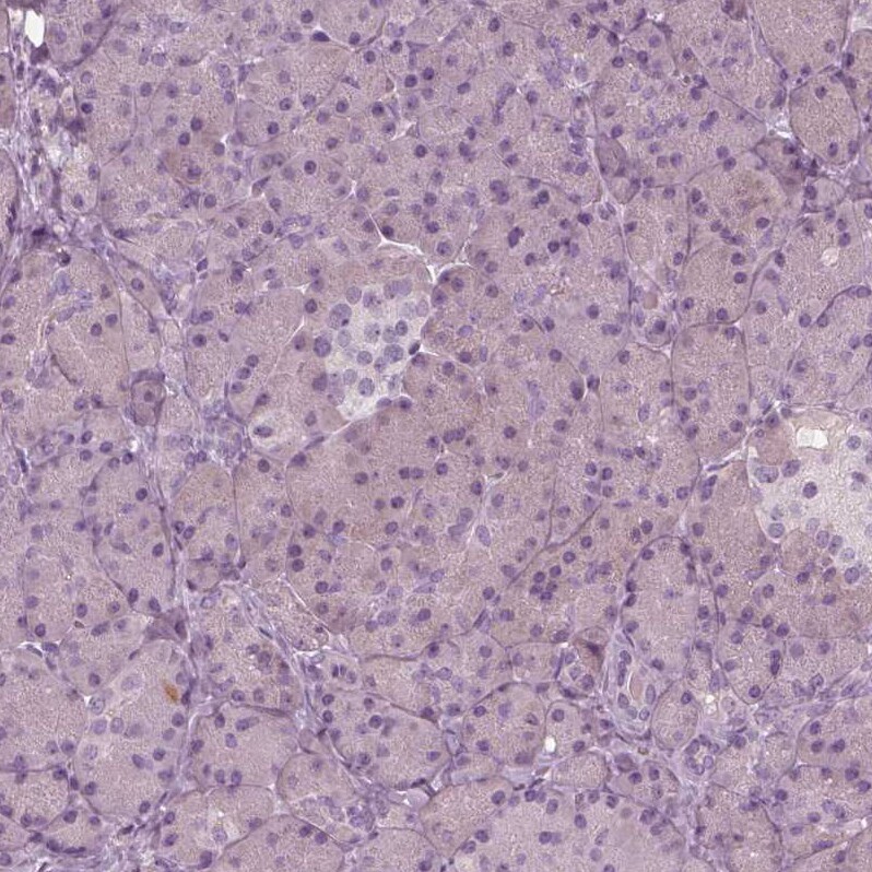 PSTPIP2 Antibody - BSA Free Immunohistochemistry-Paraffin: PSTPIP2 Antibody - BSA Free [NBP1-85846]
