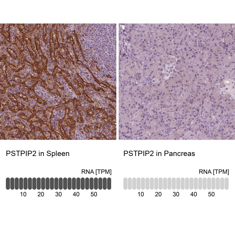 PSTPIP2 Antibody - BSA Free Immunohistochemistry-Paraffin: PSTPIP2 Antibody - BSA Free [NBP1-85846]