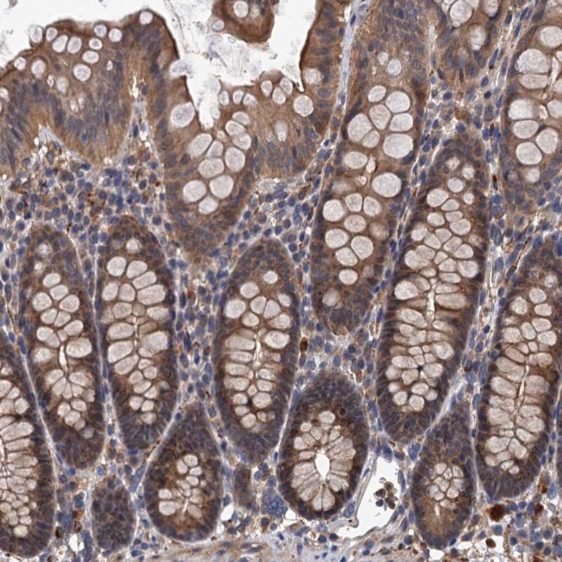 LRRC2 Antibody - BSA Free Immunohistochemistry-Paraffin: LRRC2 Antibody [NBP1-85853]