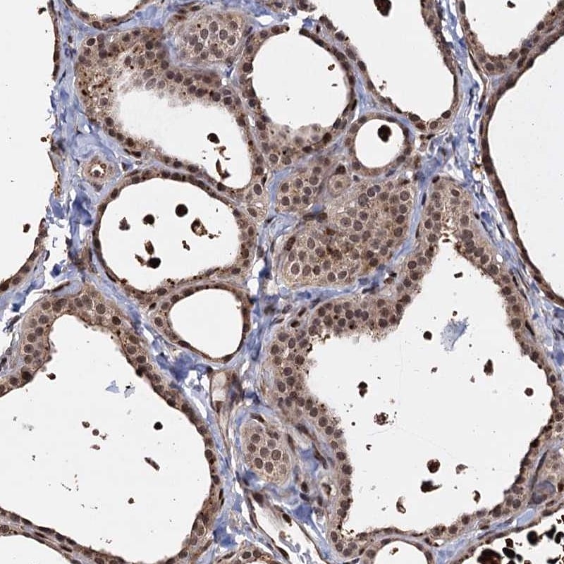 PIGB Antibody - BSA Free Immunohistochemistry-Paraffin: PIGB Antibody - BSA Free [NBP1-85856]